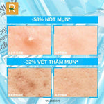 S?a r?a m?t gi?m m?n Garnier Skin Naturals Bright Complete Anti-Acne Cleansing