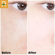 Tinh Ch?t D??ng Da V?i 20% Niacinamide + 1% Zinc Pca Tia'm Serum Niacinamide Pore Mininmizing - TI000000 - Rosslyn