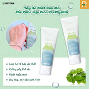 Gel t?y da ch?t PRETTYSKIN THE PURE JEJU CICA PEELING GEL 150ml - PS000000
