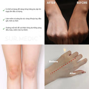 Kem Nâng Tông Da Toàn Thân SURMEDIC Super Glutathione 100™ Bright Body Tone Up Cream 150ml - SM000006 - Rosslyn