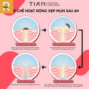 Kem Ch?m M?n TIA'M AC FIGHTING SPOT RX CREAM - TI000003