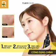 Tinh Ch?t D??ng Da V?i 20% Niacinamide + 1% Zinc Pca Tia'm Serum Niacinamide Pore Mininmizing - TI000000 - Rosslyn