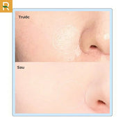 Ph?n Ph? DearMay Cherry Sebum Pact - DM000001