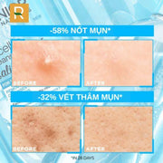 S?a r?a m?t gi?m m?n Garnier Skin Naturals Bright Complete Anti-Acne Cleansing